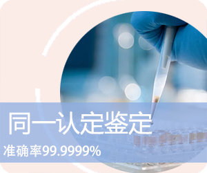 昭通DNA同一认定
