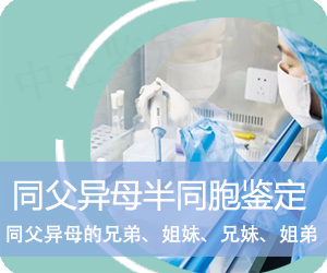 昭通同父异母半同胞鉴定