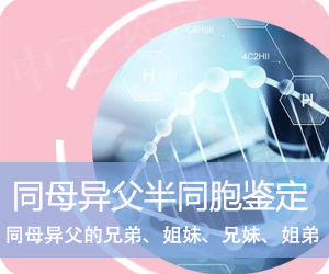 昭通同母异父半同胞鉴定